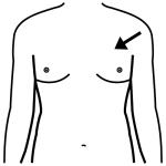 Arasaac 150-82c644d2696d443f5fede2bf8bef2369