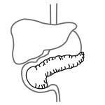 Arasaac 150-e1151519849510f504e9646d89c09597