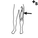 Arasaac 150-519818fed675201990b46a6ffcd557ff