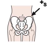 Arasaac 150-1379a64540f23f71b4bb6a40dbad3bfc