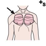 Arasaac 150-31bf5697bbfa91e1dff2f2019d802a30