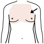 Arasaac 150-82c644d2696d443f5fede2bf8bef2369